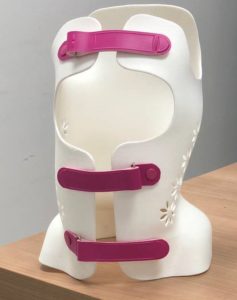 Medial 3D Printing - 3D Printing Prosthetics: Scoliosis Brace